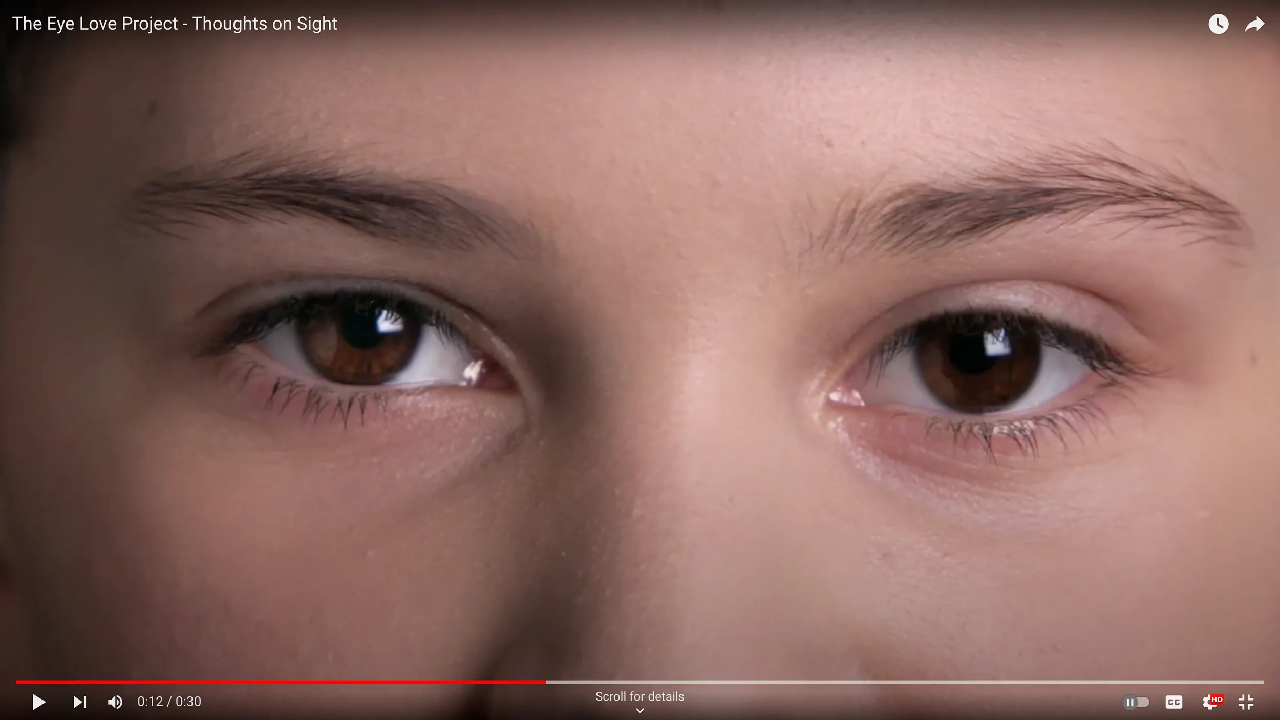 The Eye Love Project — work by Lauren French